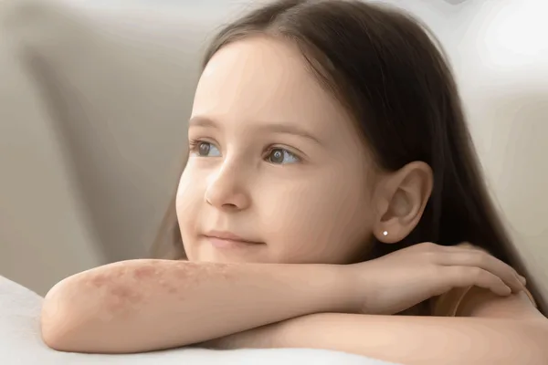 Photorealistic image, 16:9 aspect ratio: A close-up to medium shot of a young girl (appearing around 7-10 years old) with a gentle and slightly thoughtful expression. There might be a small, subtle area on her arm or hand that shows mild redness or slightly dry skin, indicative of mild eczema but not severe or distressing. Her eyes should be clear and engaging. The overall mood should be one of resilience and quiet understanding, rather than suffering. Soft, natural lighting, perhaps in a home setting (softly blurred background of a living room or child's room). Background: A plain, smooth background in a single, soft, calming beige or light oat color, ensuring a gentle and non-distracting feel. The image should evoke empathy and understanding for individuals living with atopic eczema, focusing on the person rather than just the condition in an alarming way