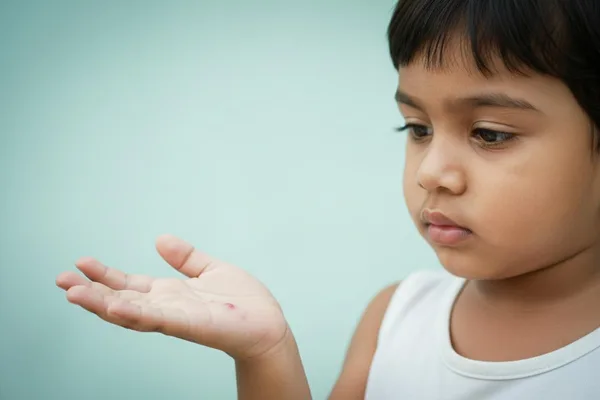 ඔයාගේ පොඩ්ඩටත් මේ වගේ බිබිලි ඇවිල්ලද? අත්, පා සහ මුඛ රෝගය (Hand, Foot, and Mouth Disease) ගැන හරියටම දැනගමු!